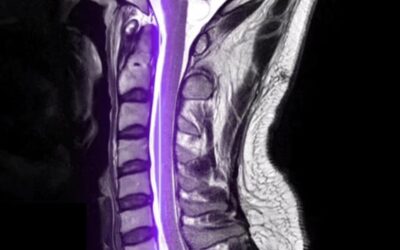 CT Scans: Fast, Precise Imaging for Better Diagnosis at Bay Outpatient Radiology