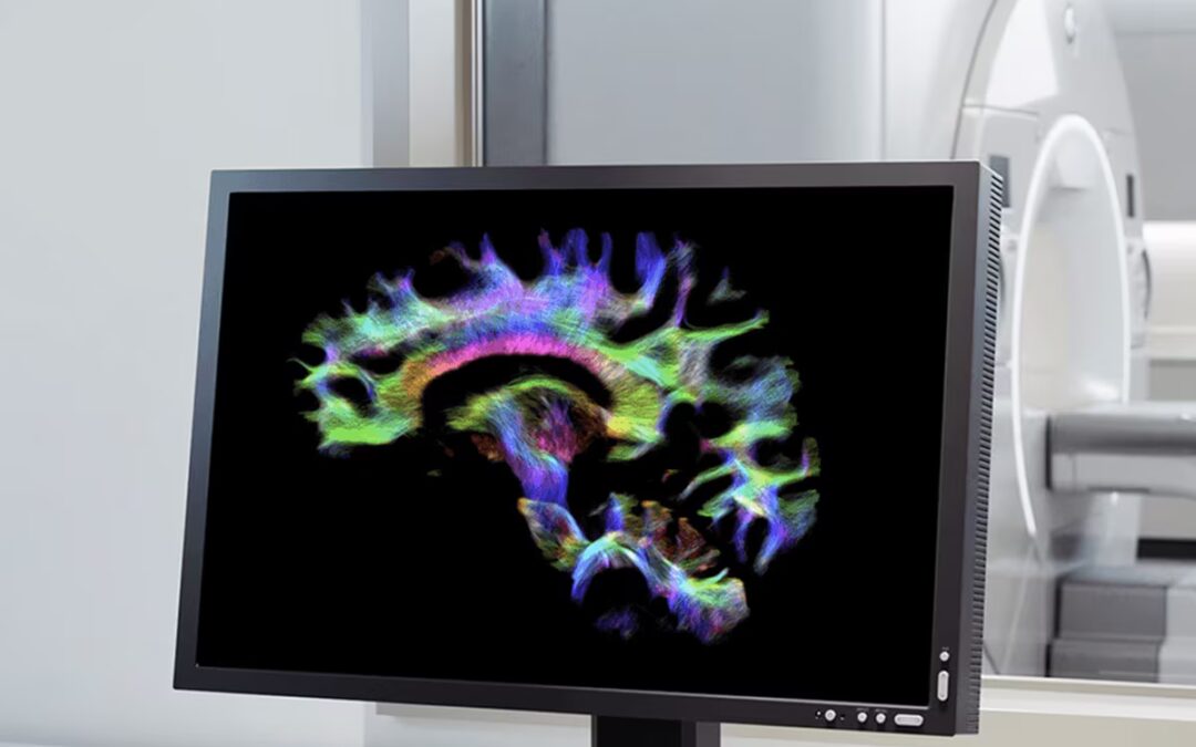 Say Hello to a Calmer, Faster CT Scan at Bay Outpatient Radiology